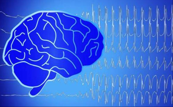 老年癫痫：这些常见病因与误区要警惕！