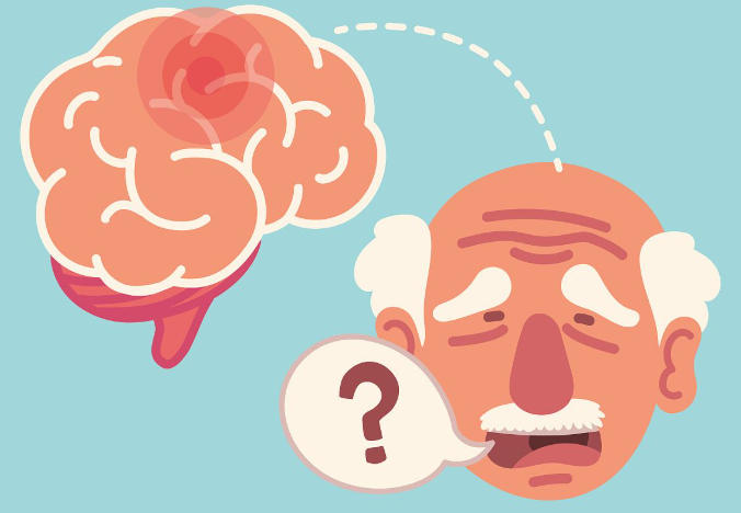 老年癫痫易被忽视！这4个信号要警惕，子女必看