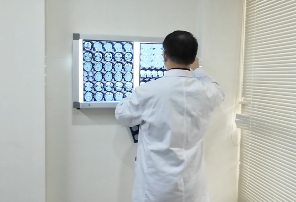 MDT会诊进行时|北京大学首钢医院高伟主任亲诊武汉中际医院：让复杂疑难脑病患者在家门口得到精准评估!