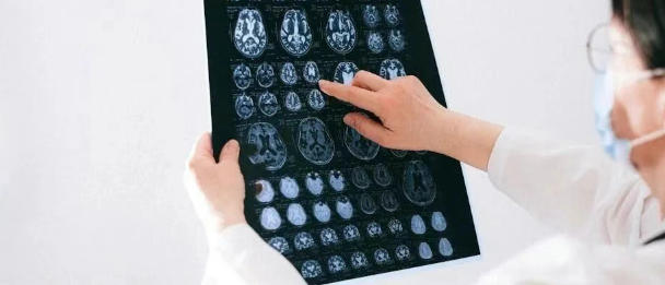 有病灶才会抽？一文分清原发、继发性癫痫不同发作表现